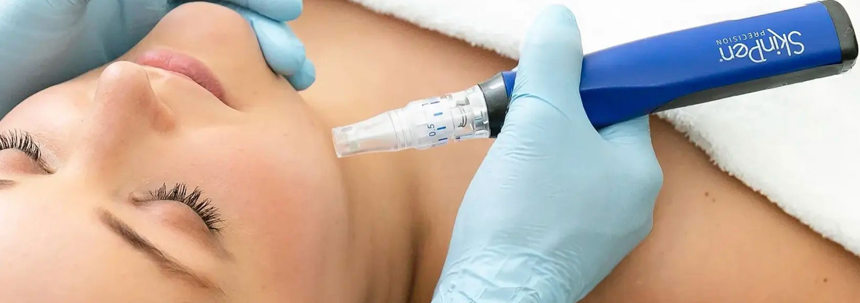 SkinPen Microneedling